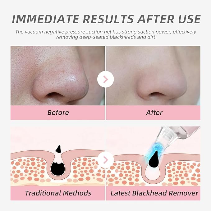 Blackhead Remover Vacuum, Pore Cleaner Blackhead Extractor, Pore Vacuum with 3 Adjustable Suction Levels & 4 Probes, USB Rechargeable Blackhead Remover Tools for Face & Nose (Pink)