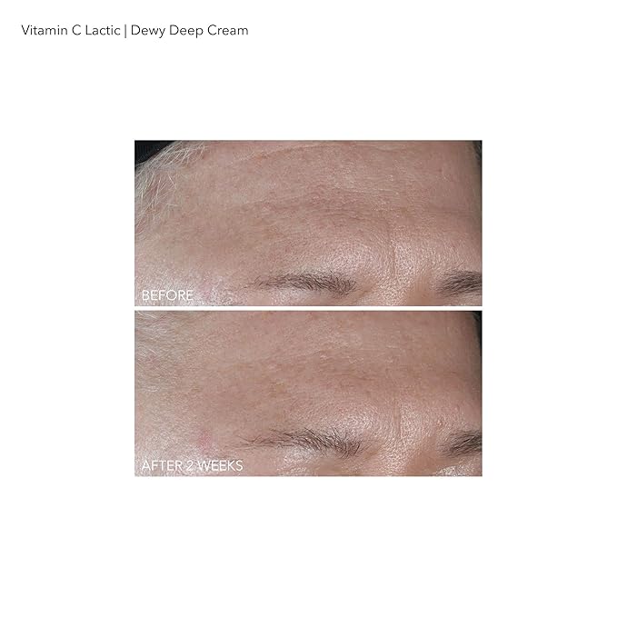 Dr Dennis Gross Vitamin C Plus Lactic Dewy Deep Cream Cream Unisex 2 oz