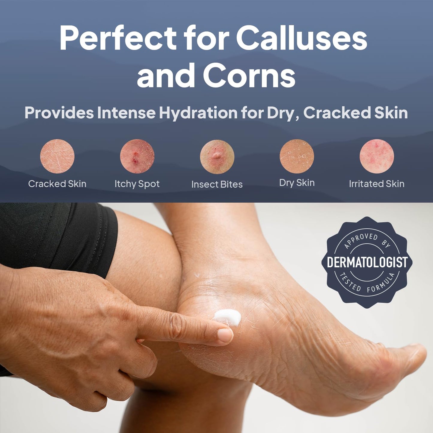 Pumice Valley 2 Pack Foot Cream for Dry Cracked Feet and Heels - Natural Moisturizer, Corn, Calluses Treatment - Skin, Body Loti