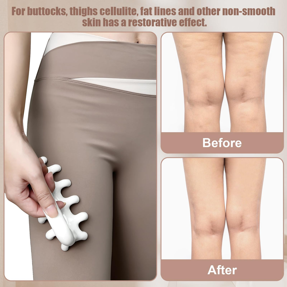 Vemoky Fascia Massage Tool Trigger Point Massage Tools Anti Blaster for Cellulite Massager Tool Reaching Deep Myofascial Tissue Throughout The Body Release Muscle Knot Reduction Cellulite