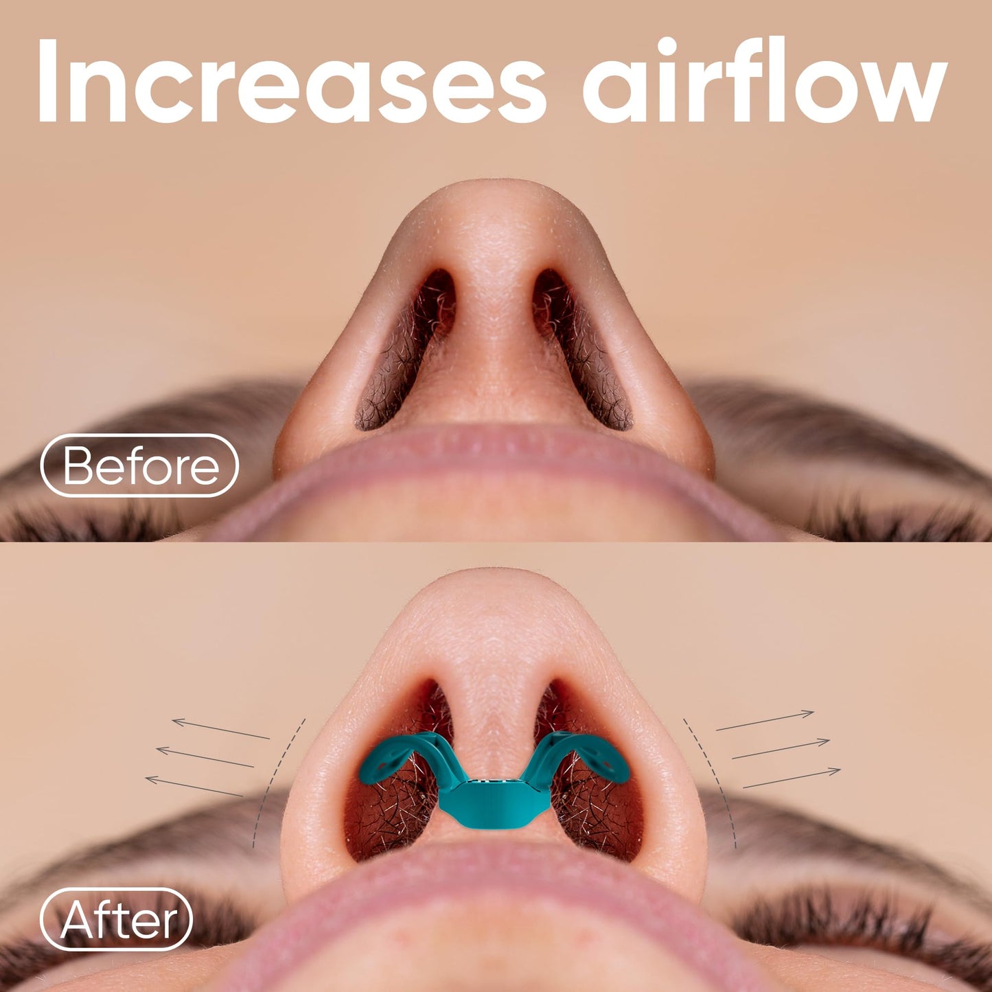 Brison Nasal Dilators for Breathing and Sleeping - 2 Pack Anti Snoring Nose Vents Opener for Better Breathing Sleeping and Activity Improves Airflow - 2pcs
