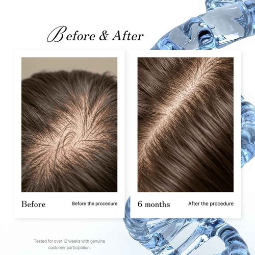 Simone Tec Hair Essentials DNA-Pollen Hair Growth Stimulating Treatment Proven Effective Against Hair Loss for Thicker and Fuller Hair