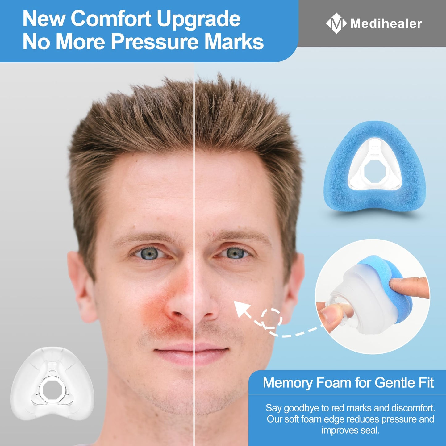 Medihealer Upgraded N20 Nasal Cushion for Airfit N20 Nasal Mask(M), 2 PCS Ultra Comfortable Memory Foam Cushion Compatible with Airfit N20, Great Value CPAP Supplies （Blue）