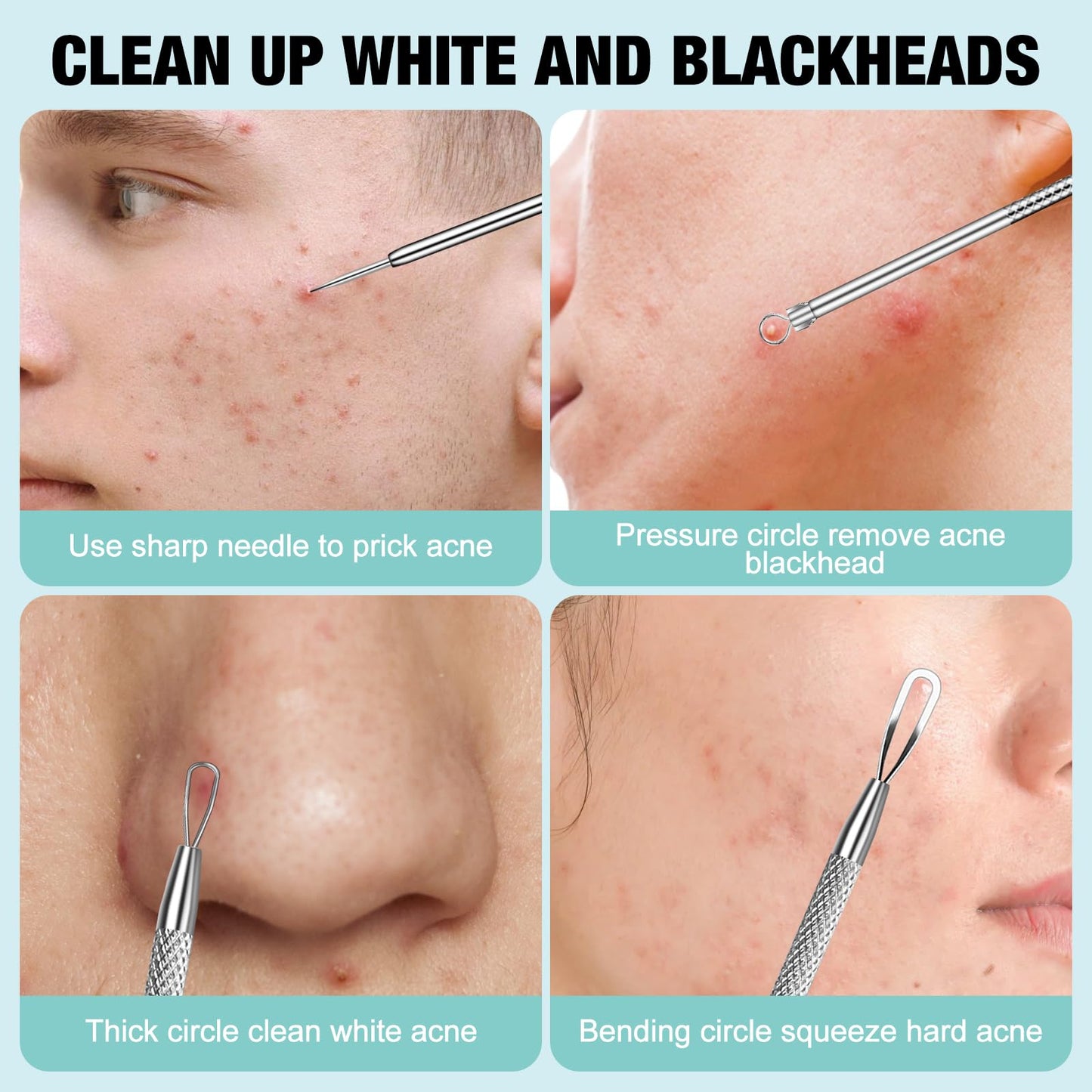 MUIIGOOD 3Pcs Blackhead Remover Pimple Popper Tool Kit Pimple Extractor Acne Treatment Surgical Grade Blackhead Comedone Removal