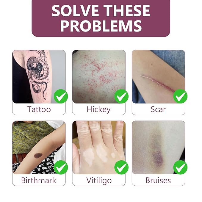 Tattoo Cover Up Patch, Invisible Tattoo Cover Up Makeup Waterproof and Sweatproof, Ultra Thin T-attoo C-over Up Tape for T-attoos,Scars & Spots