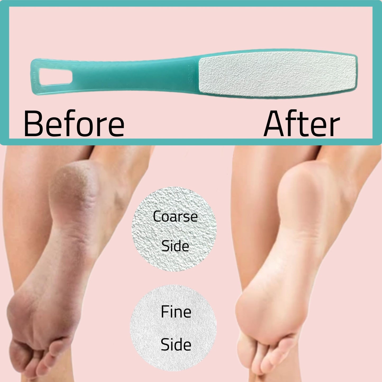 3 ALAZCO Double Sided Foot File Pumice Ergonomic Handle Scrubber Immediate Result Smooth Feet Heel Scraper Exfoliate Buffer Dead