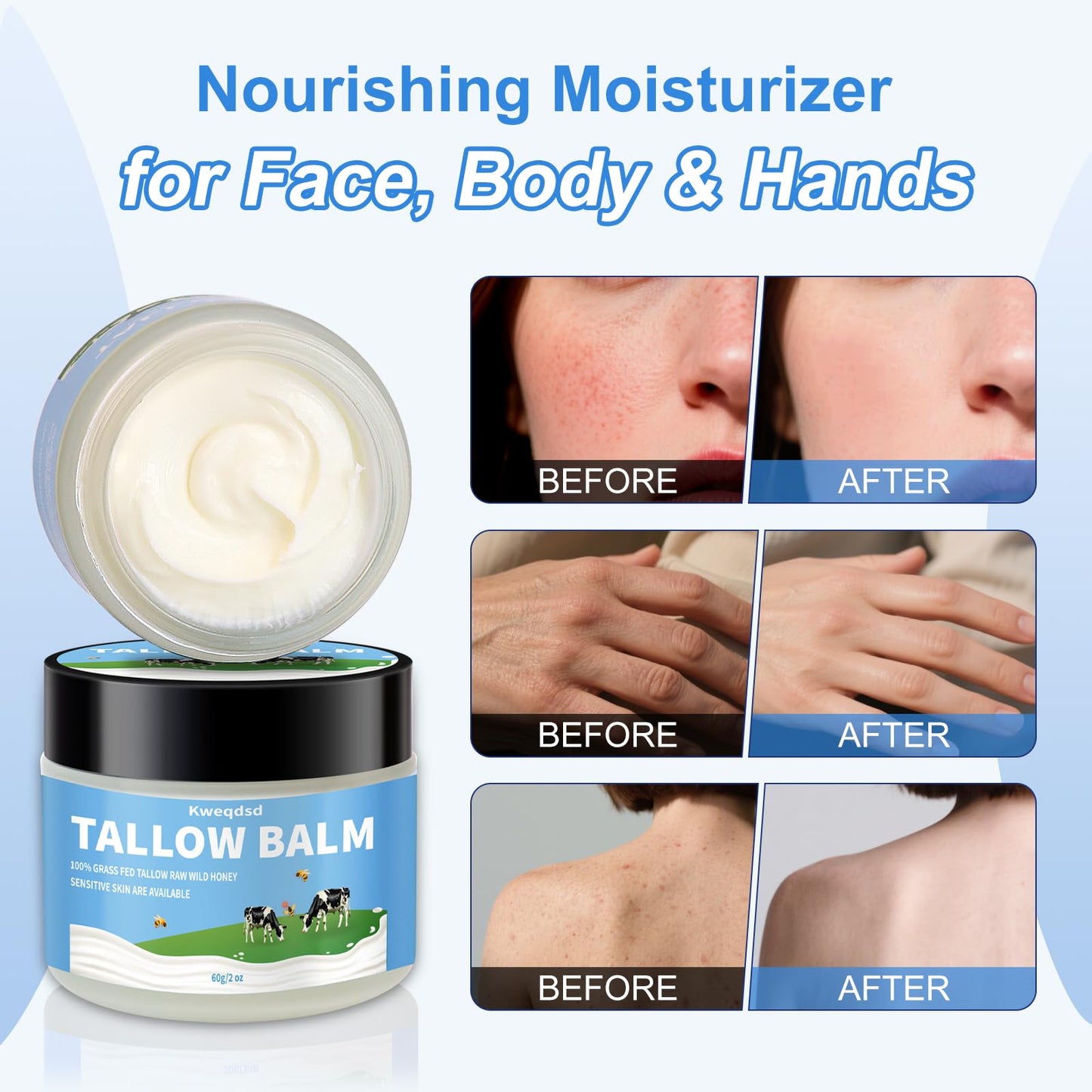 Kweqdsd 5 Pack Organic Grass-Fed Beef Tallow Balm with Raw Honey, Grass Fed Beef Tallow Face Moisturizer, Natural Tallow Skin Ca