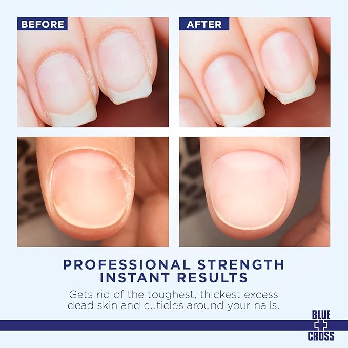 Blue Cross Hydrating, Moisturizing, Strengthening Cuticle Remover Oil with Lanolin + Extra Strength Callus Remover Gel for Heel or Feet, 6 oz each, 2 pack Bundle