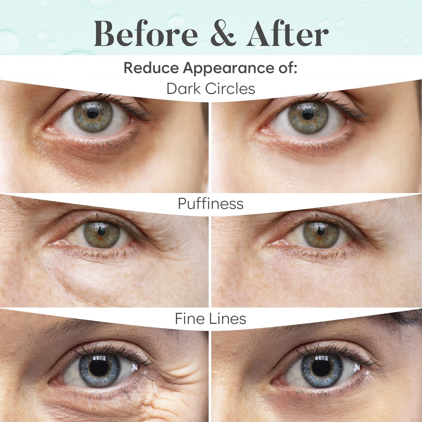 Aloe Vera Under Eye Patches (30 PAIRS), For Puffy Eyes and Dark Circles, Under Eye Mask with Hyaluronic Acid & Hydrolyzed Collag