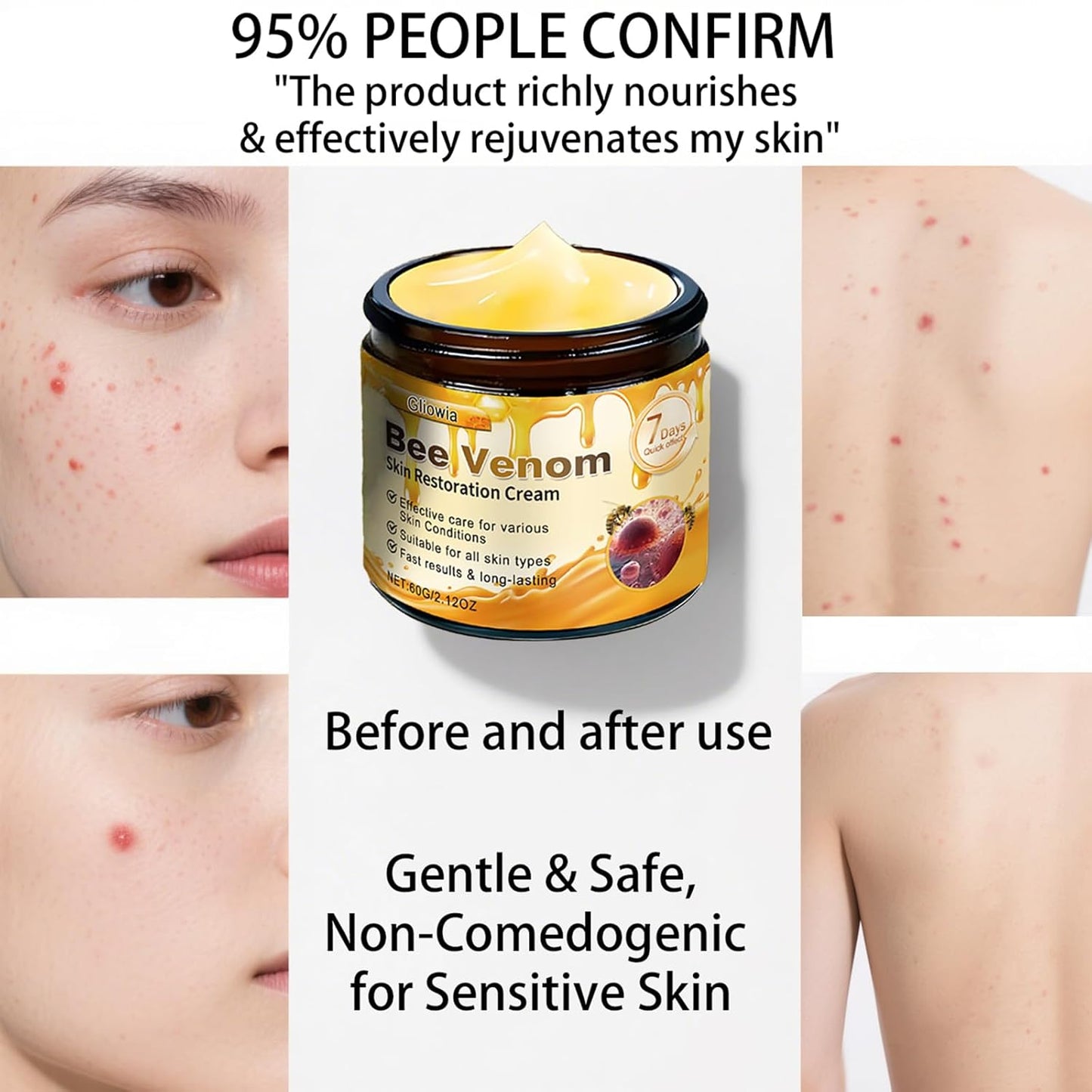 2PCS Bee Venom Skin Restoration Cream, 2025 Upgrade Bee Venom Skin Treatment Cream, Natural bee venom cream for Repair & Renewal, All in One Nourishing Serum for All Skin Types
