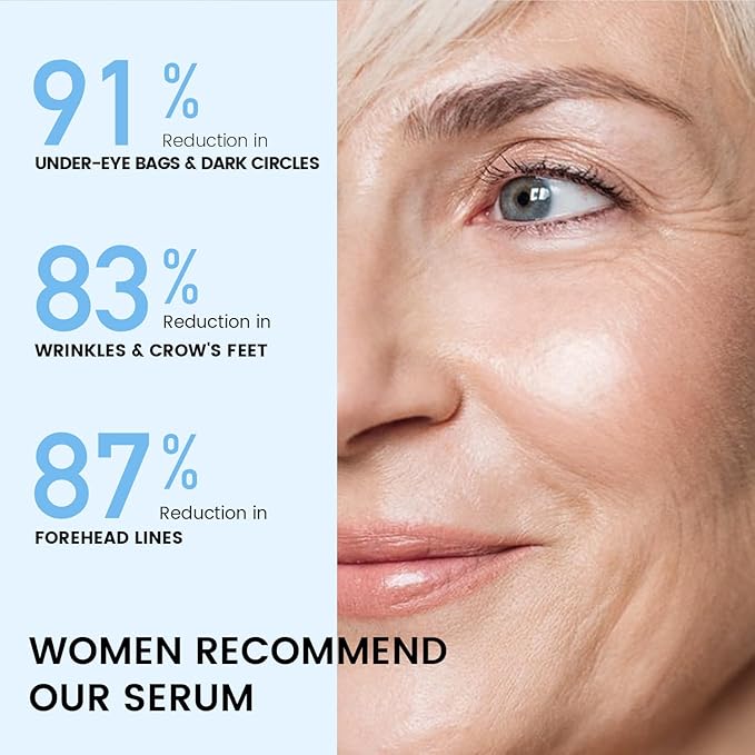 Instant Eye Face Lift Cream: Reduces Eye Bags Wrinkles Puffy Eyes Dark Circles Crow’s Feet in Minutes for Mature Skin of Middle-aged Women 1 Fl Oz
