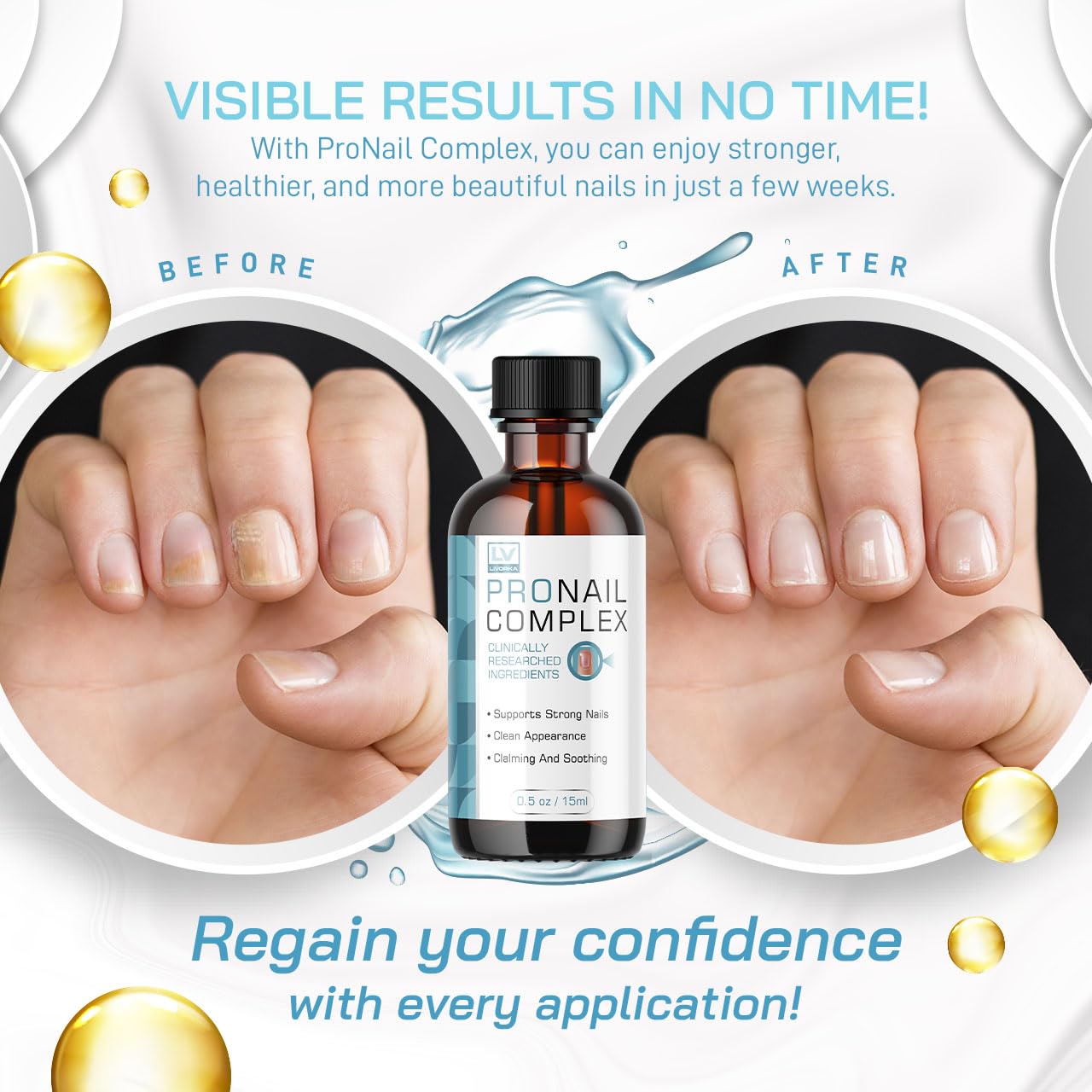 Pronail Complex - Original Formula Toenail Treatment Pronail Complex Liquid Drops Premium Formula Extra Strength, Pro Nail Complex Oil Liquid Drop All Natural Support, 1 Bottle for 1 Month