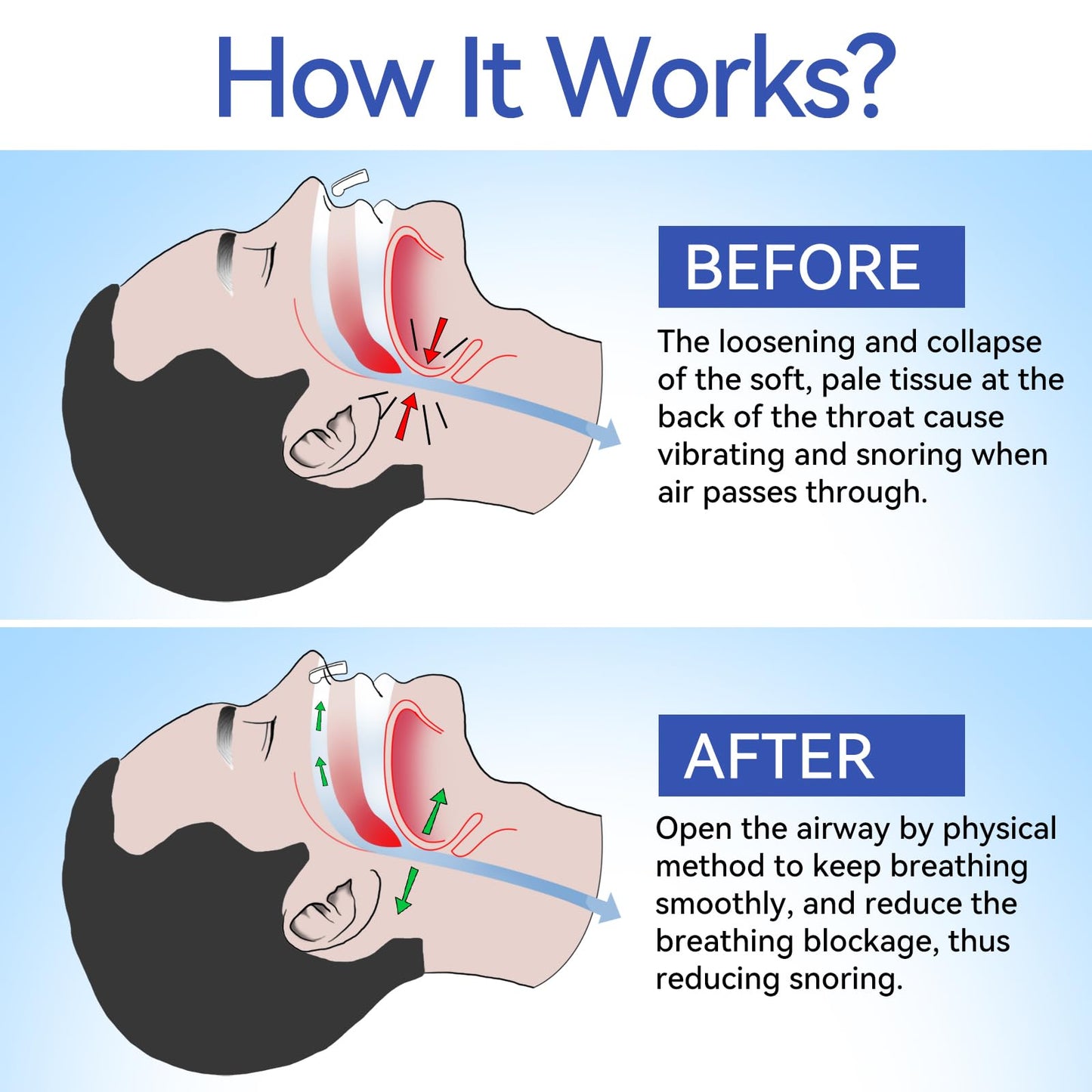 Anti Snoring Devices, Anngola Snoring Solution, Silicone Magnetic Anti Snoring Nose Clip, Effective Hale Breathing Aid, Stop Snoring to Restful Sleep(10 Pack)