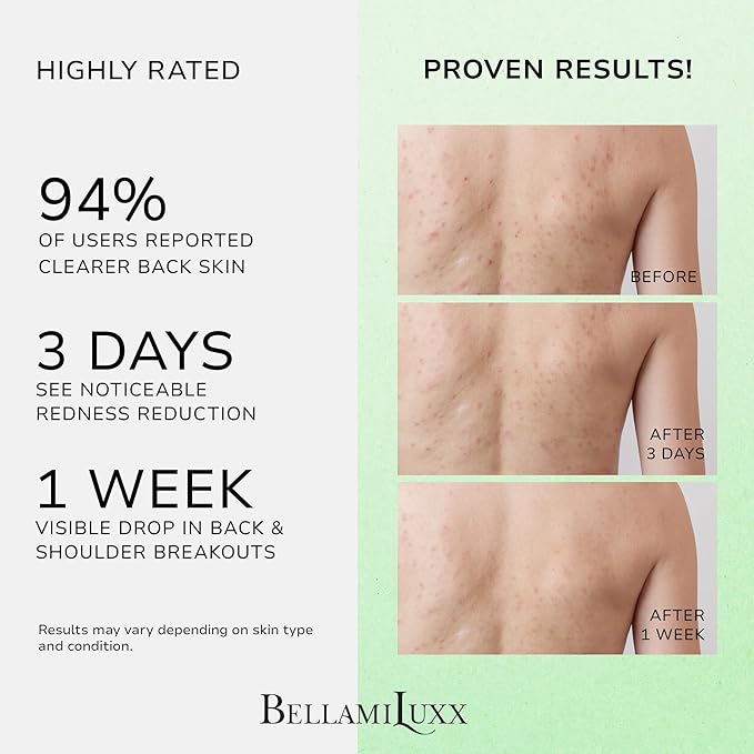 Back Acne Spray + KP Bump Eraser Body Scrub – Complete Body Acne & Texture Treatment Set