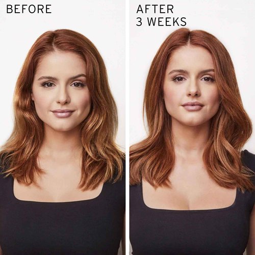 Fekkai Technician Color Conditioner - 1 Liter - Extends Vibrancy of Color-Treated Hair - Free of Sulfates, Parabens, Phthalates - Vegan, Cruelty-Free