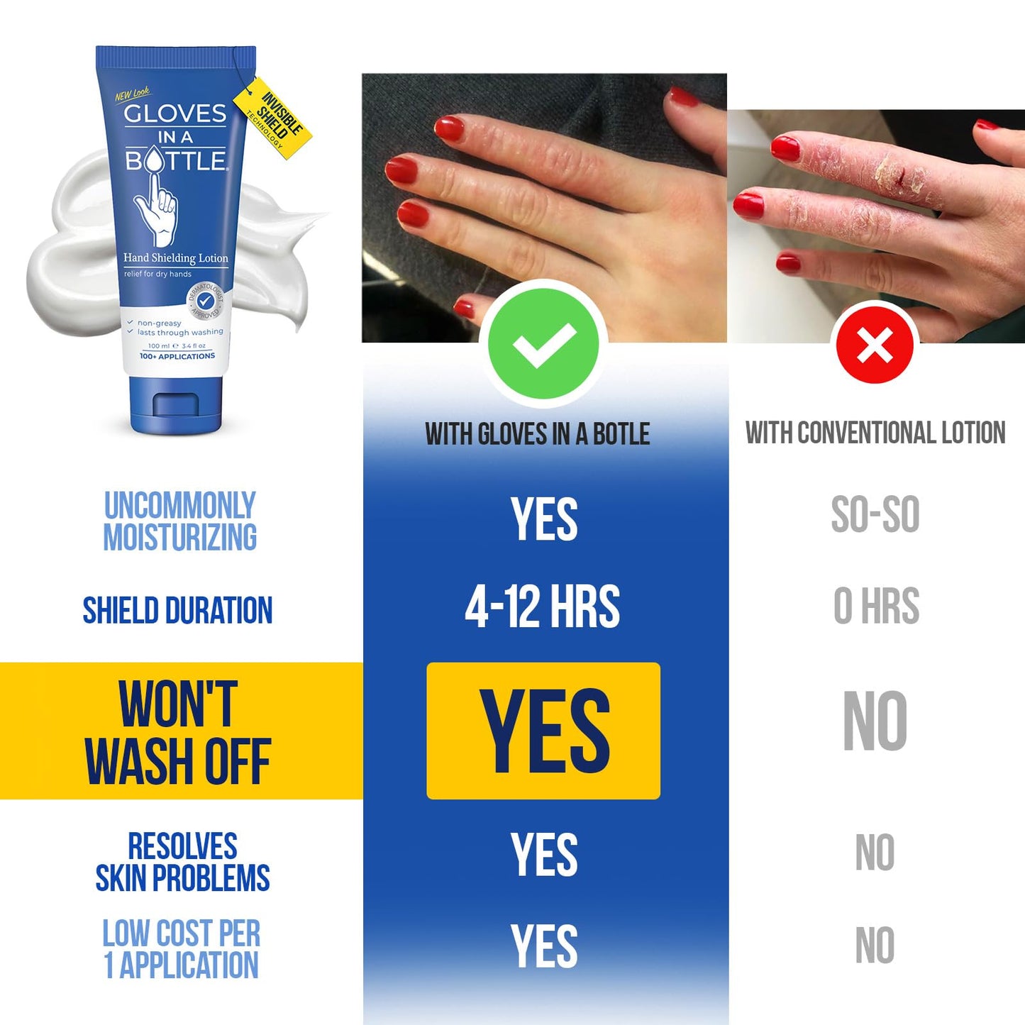 Gloves In A Bottle Psoriasis Eczema Relief Hand Lotion Travel Size - Shielding Lotion for Women, Men, 6 months old or older babi