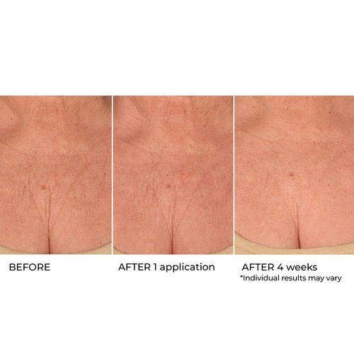 NassifMD Age Defying Neck & Décolleté Serum, Lifts and Firms Thin Neck Skin, Hydrates and Smooths