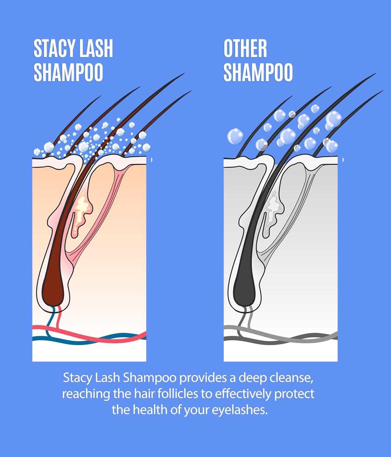 STACY LASH 6.76 fl.oz / 200ml Eyelash Extension Shampoo + Brush/Eyelid Foaming Cleanser/Wash for Extensions & Natural Lashes/Safe Makeup Remover/Supplies for Professional & Home Use