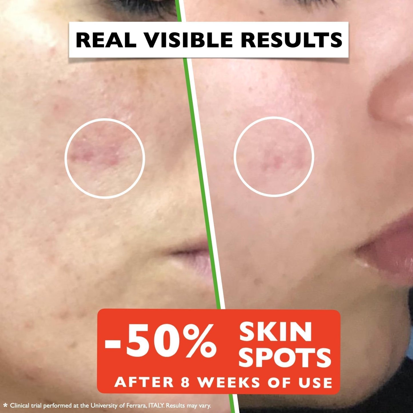 Vitamin C Serum For Face - Anti-Aging Facial Serum with Vitamin C, Hyaluronic Acid, Niacinamide, B5 & Vit E. Brightening Facial