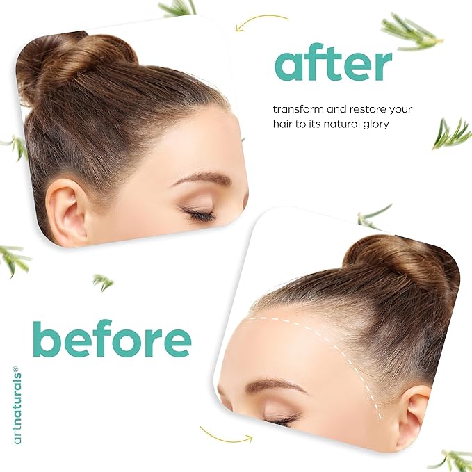 Rosemary & Castor Hair Growth Oil