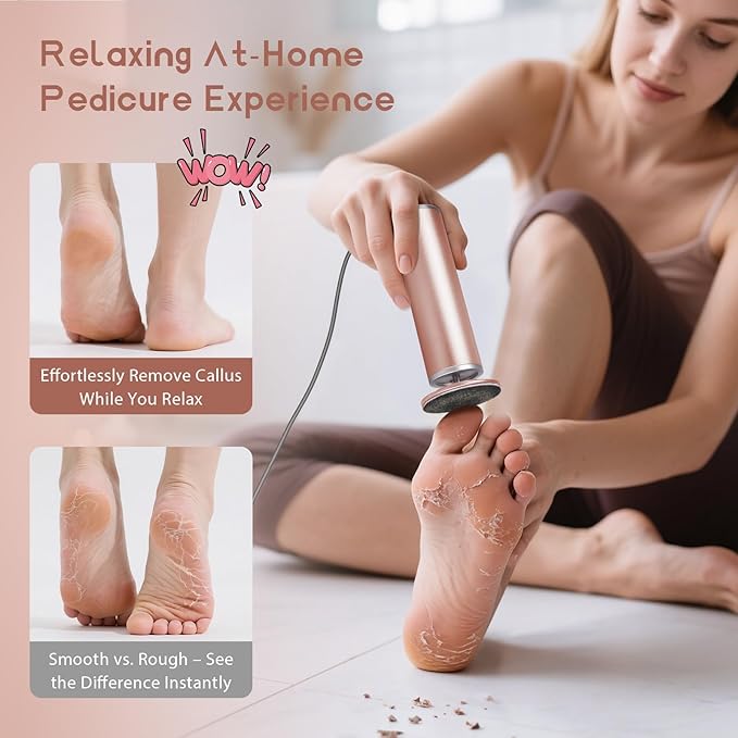 Electric Foot Callus Remover with 60pcs Sandpaper Discs, 4.8IN Aluminum Foot File for Dead Skin and Cracked Heels, 800RPM Professional Pedicure Tool for Home Spa Use