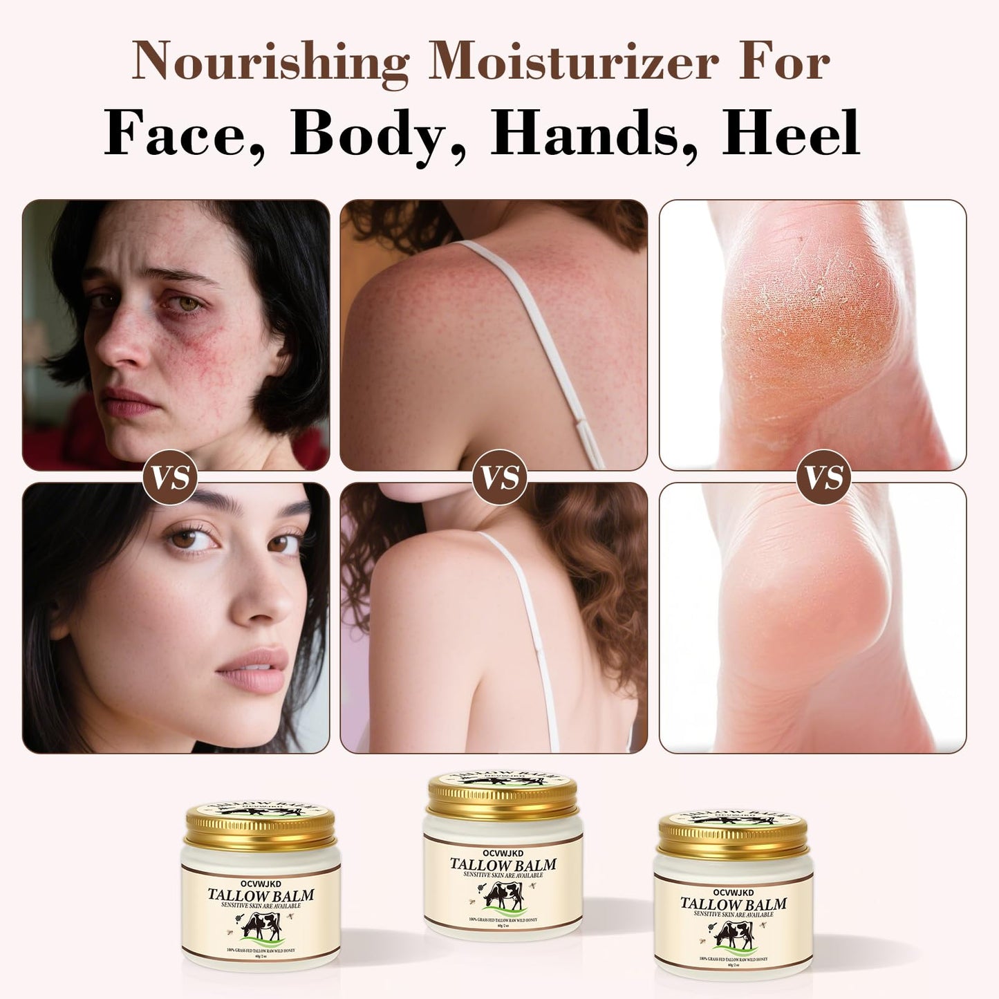 OCVWJKD Beef Tallow & Honey Balm, Beef Tallow for Skin, 3 Packs All-Natural Moisturizer Hydrates and Nourishes the Skin, Grass-F