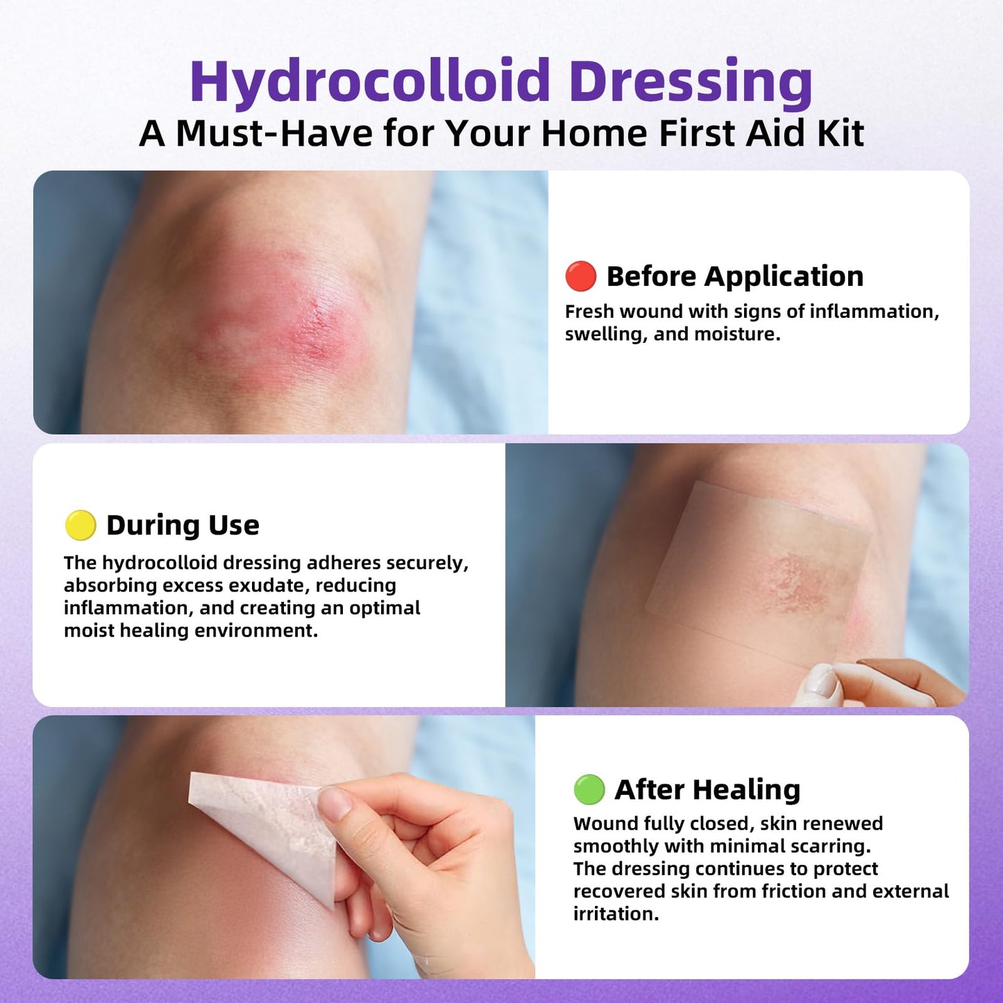 Hydrocolloid Bandages for Wound Care, Hydrocolloid Roll with Self-Adhesive,Ultra Absorbent, Flexible & Waterproof, DIY Size & Shape First Aid Kit Essential (2in*5ft)