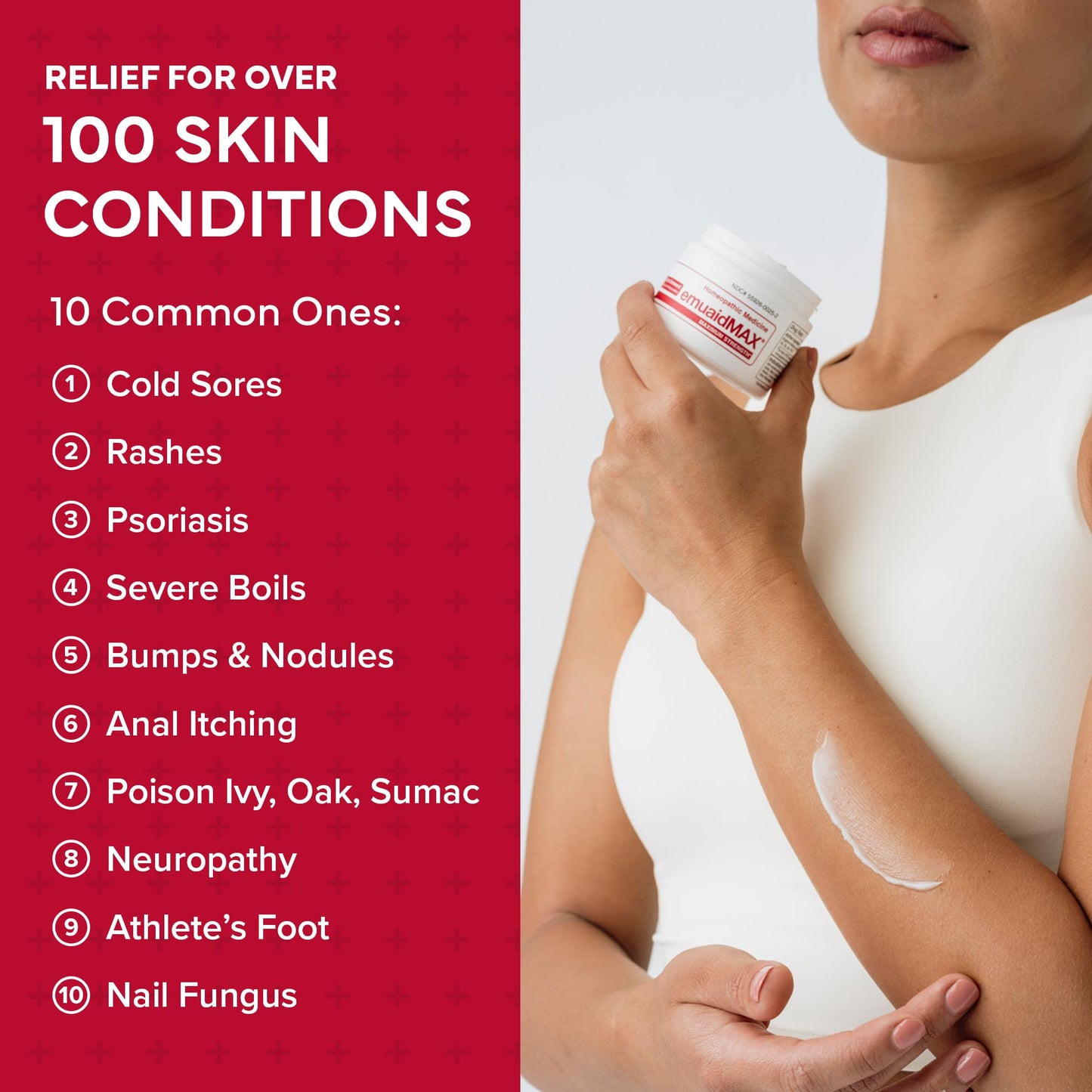 emuaid EMUAIDMAX Eczema Ointment, Maximum Strength Soothing Relief for Eczema, Psoriasis, Athlete’s Foot, Jock Itch, Rashes, Itchy, Dry, Irritated Skin and Minor Skin Irritations, 16oz
