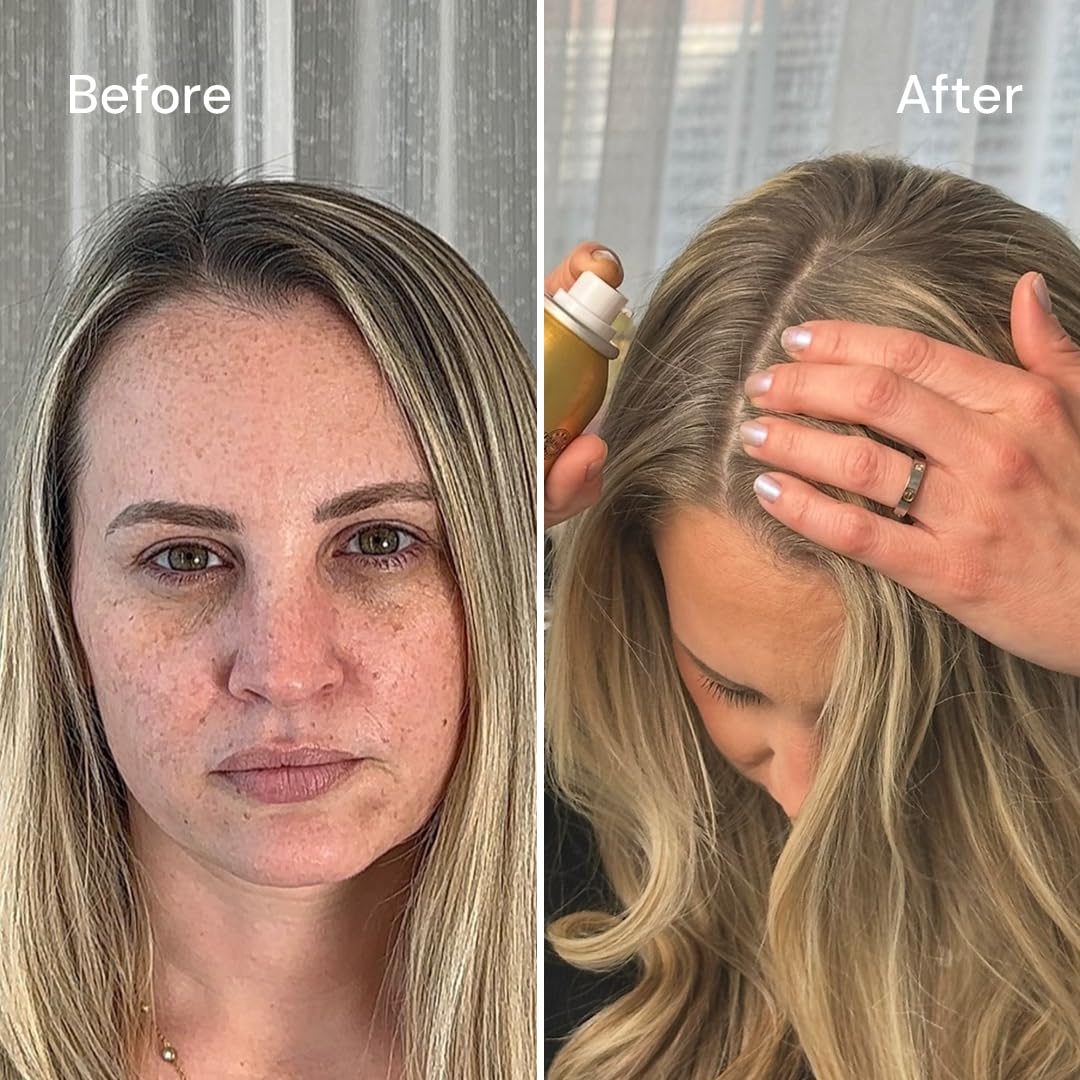 STYLE EDIT DARK BLONDE Root Concealer Touch Up Spray, Instantly Covers Greys And Dark Roots - Professional Salon Quality Blonde
