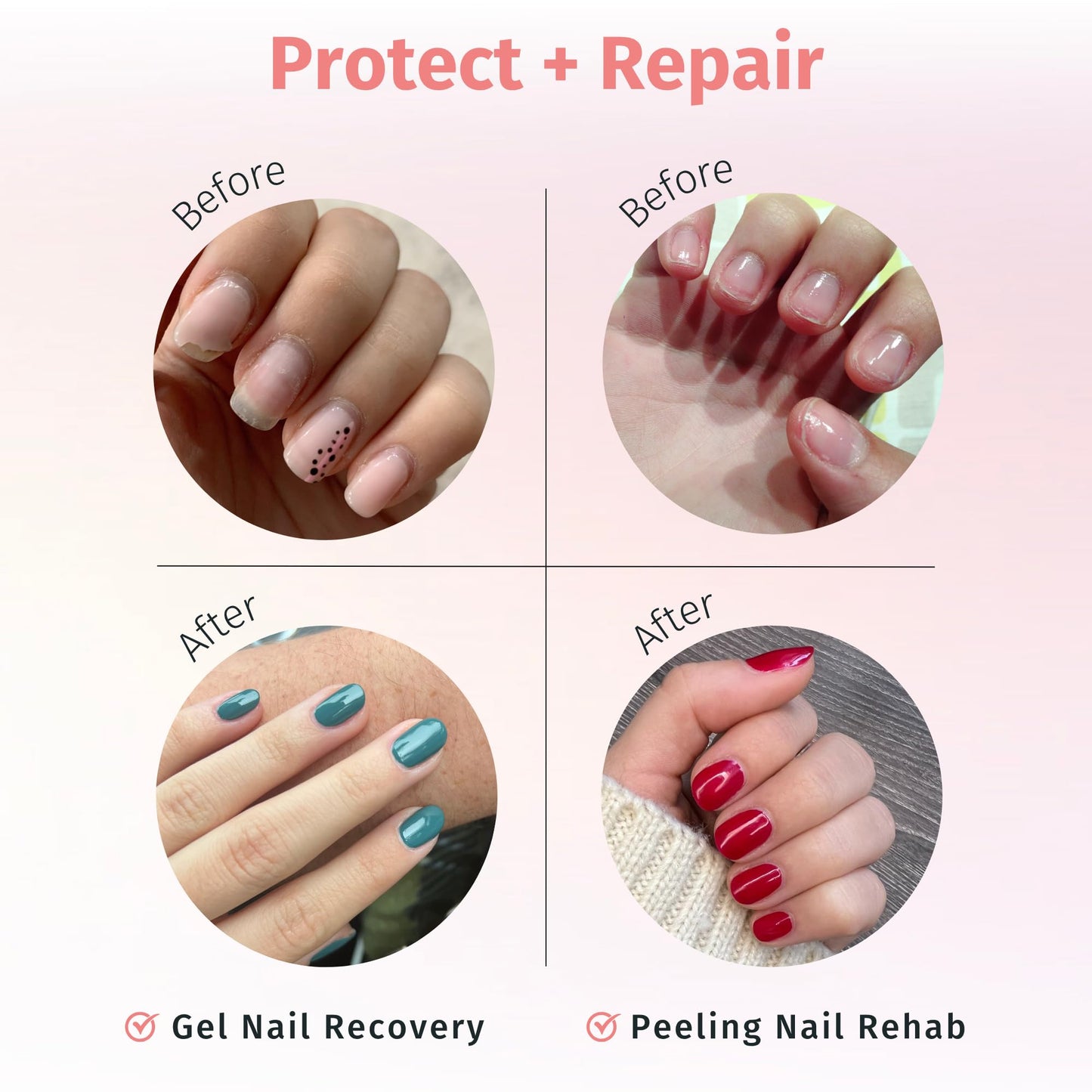 duri Rejuvacote 1 Nail Growth System - Maximum Strength | Nail Strengthener for Damaged Nails from Gel, Acrylic Manicure | Grow
