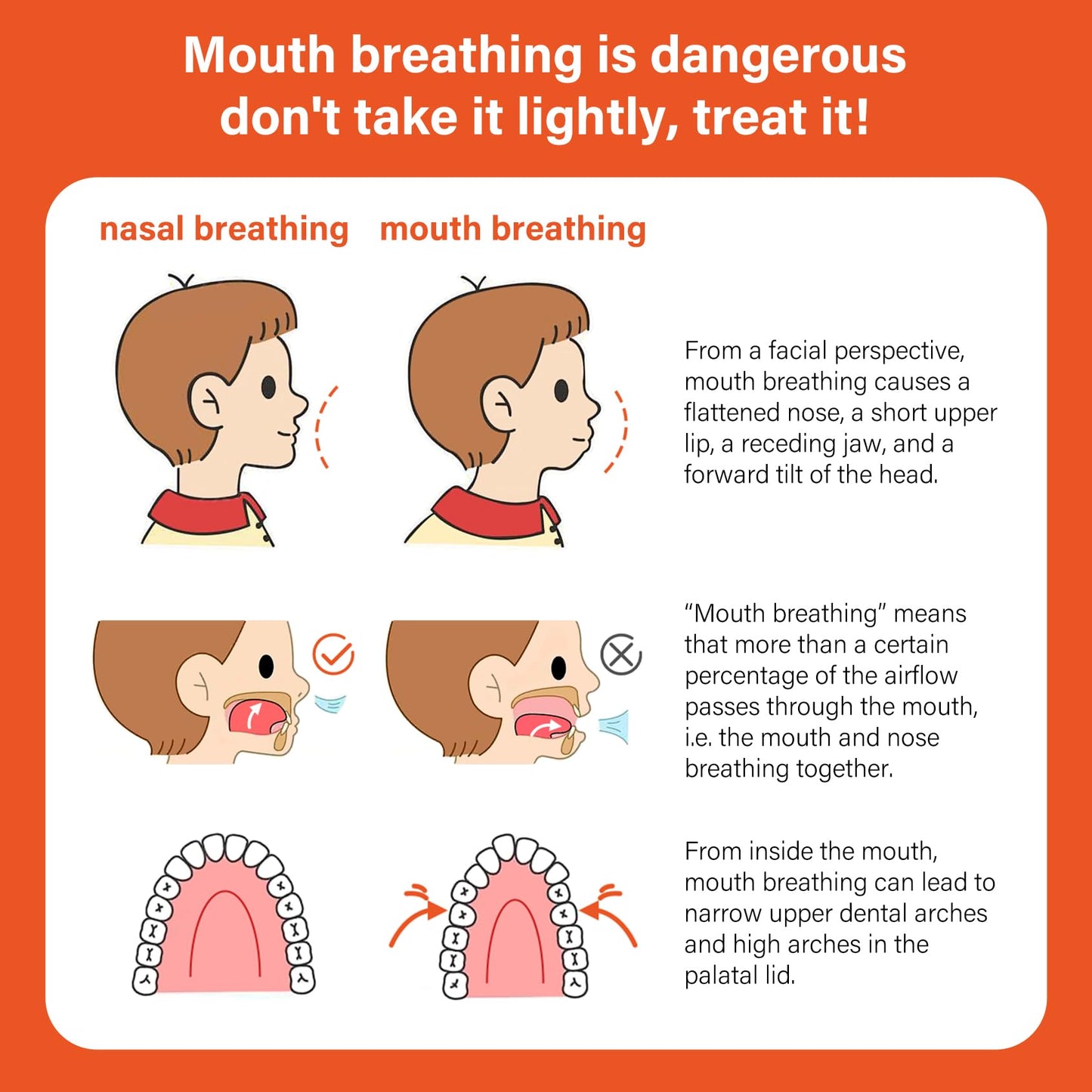 30pcs Mouth Breathing Correction Patch, Children's Closed Mouth Patch, Adult Anti-snoring, Closed Mouth Patch, Improve Mouth Breathing Facial Problems (Small（3-7years）)
