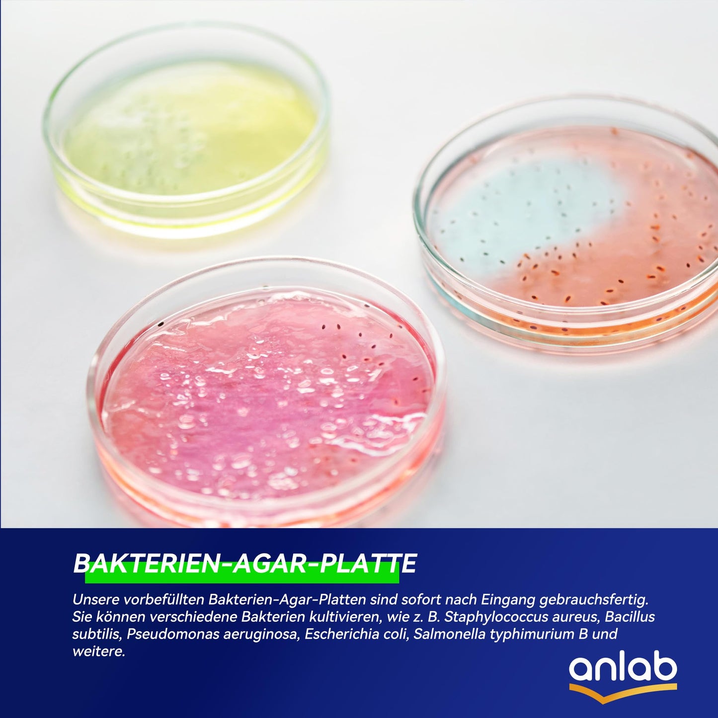 Nutrient Agar Petri Dishes Science Project Kit | Pre-Poured Agar Plates and Cotton Swabs for Science Experiments | Bacteria Science Kit - Sealed Separately (Items of 10)
