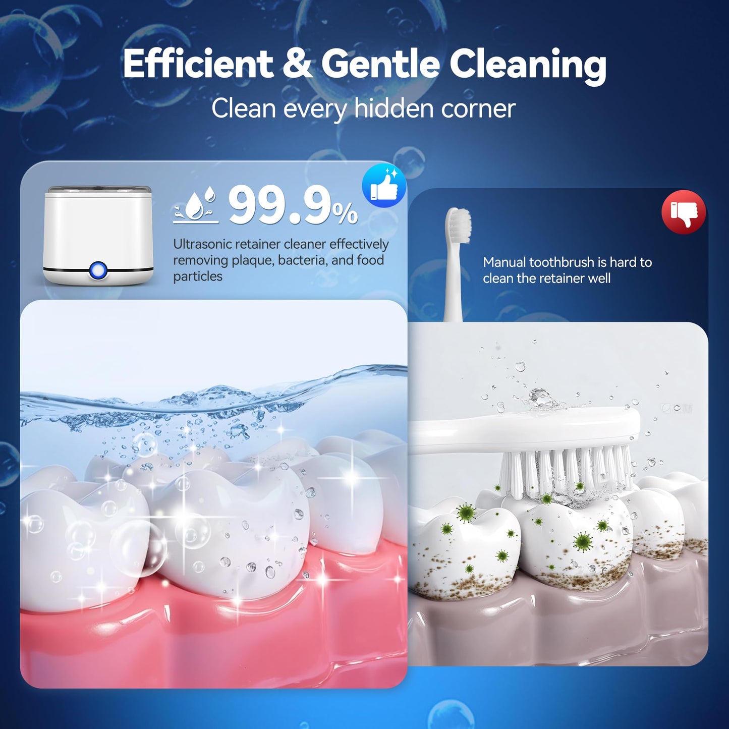 Miorcols Ultrasonic Retainer Cleaner, 48kHz Retainer Cleaner Machine for Dentures, Mouthguard, Braces, Night Guard, Toothbrush, Jewelry with 7.8OZ Dental Cleaning Pod-Cool White