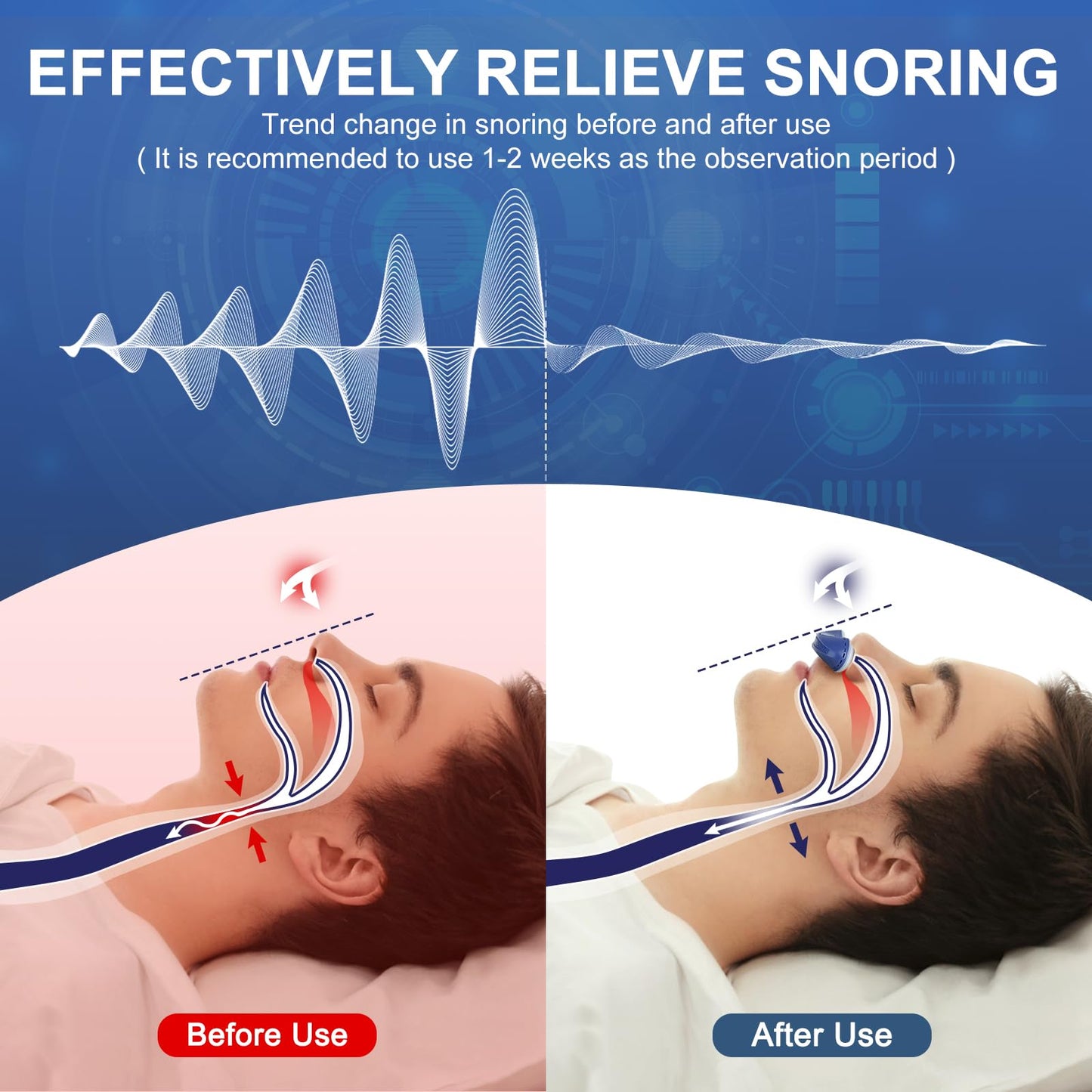 Anti Snore Device,Electric Stop Snoring Solution,Mini Portable Anti Snoring Devices Stopper,Adjustable Wind Speed Snoring Prevention Nasal Dilators for Men & Women Travel（Blue)