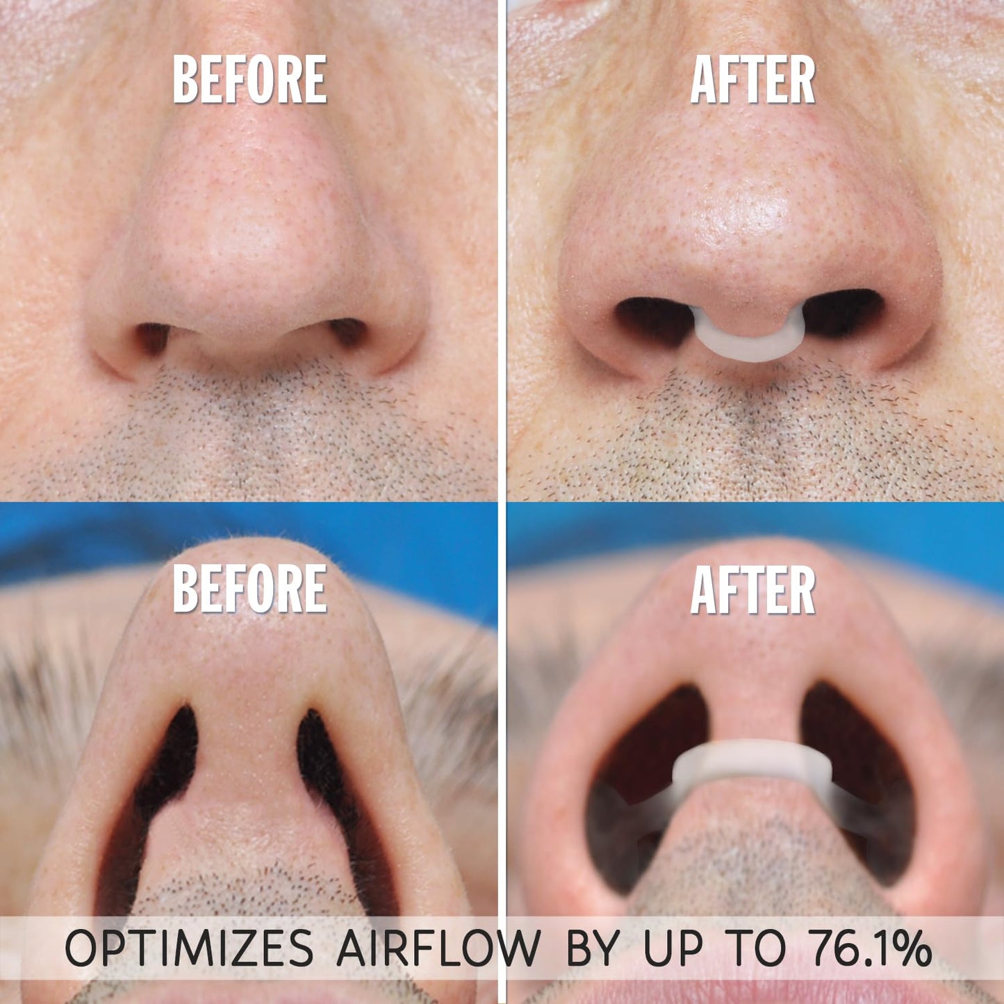 AIRMAX Nasal Dilator for Better Sleep - Natural, Comfortable, Anti Snoring Device, Snoring Solution for Maximum Airflow and Easier Breathing (Medium - Clear)