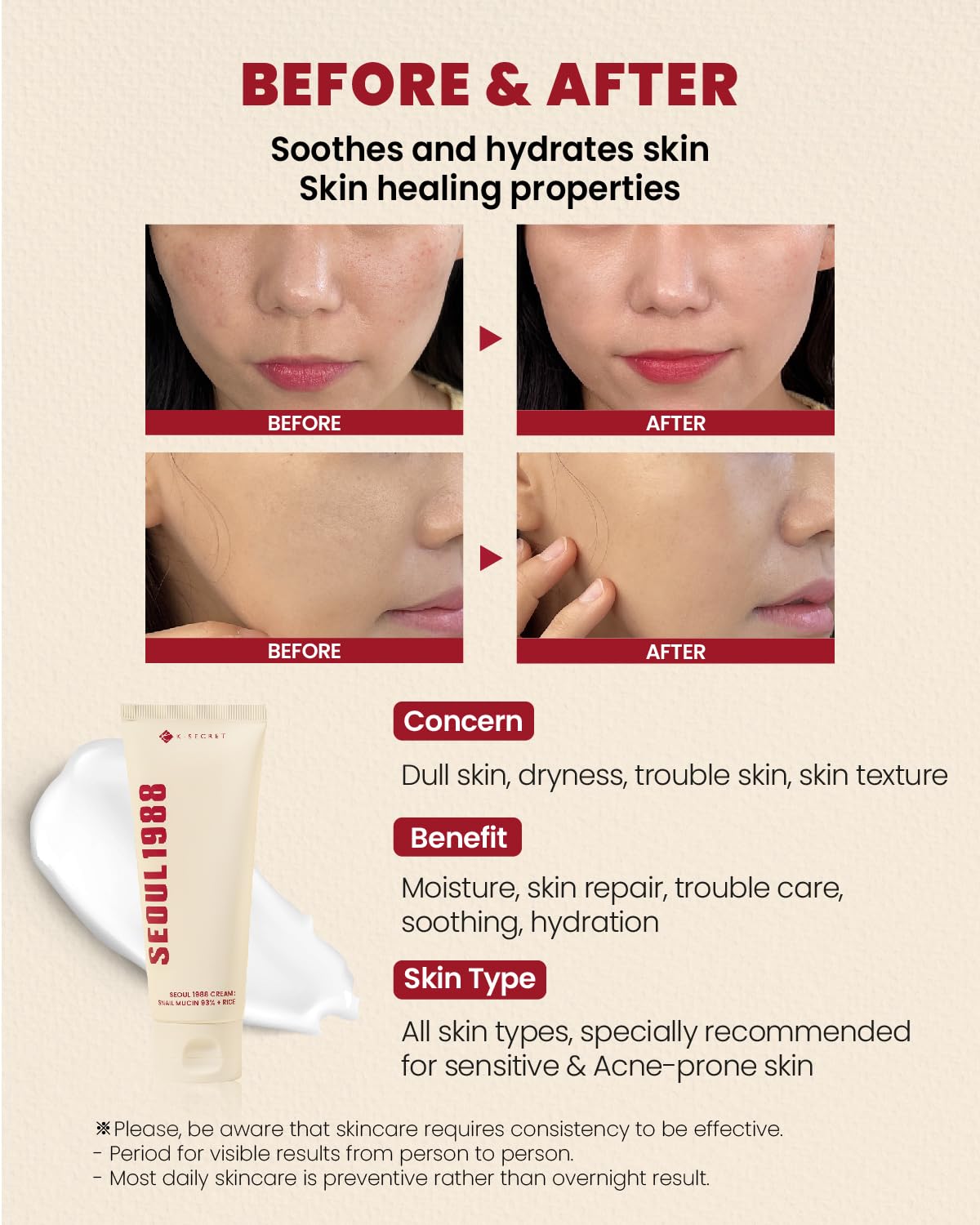 KSECRET SEOUL 1988 Cream : Snail Mucin 93% + Rice, 100ml/3.38fl.oz.