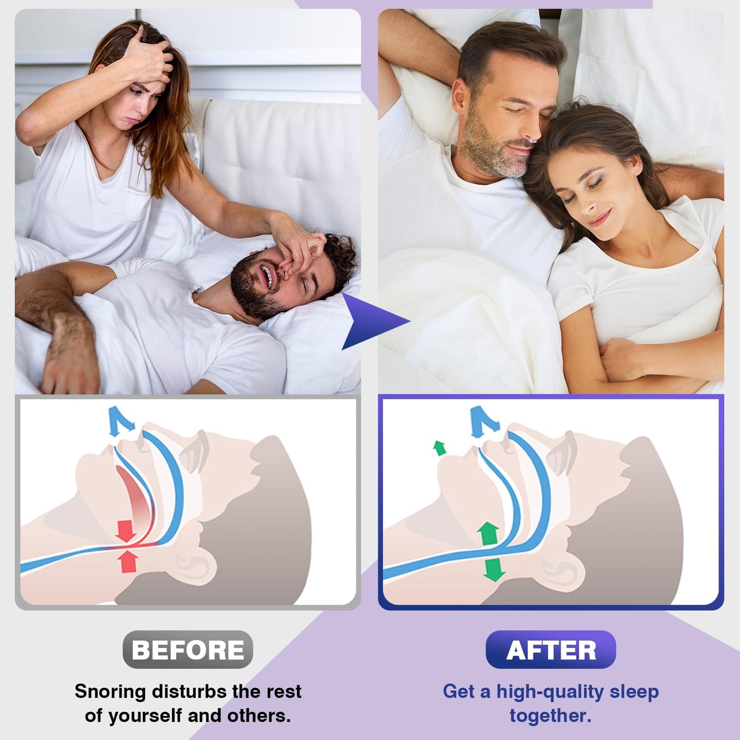 OHALEEP Anti Snoring Devices, Snore Stopper with Adjustable Magnet, Silicone Nose Clip Stop Snoring, Effective to Relieve Snoring, Snoring Solution for Comfortable and Quieter Sleep, White,M