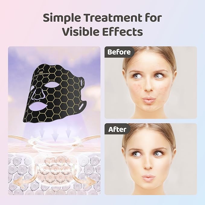 Yahi Red Light Photon Facial & Neck Mask with Remote Control, 7 Custom Modes with Infrared, Portable & Rechargeable with Timer for Home Use, 175 High-Density Light Beads, Black
