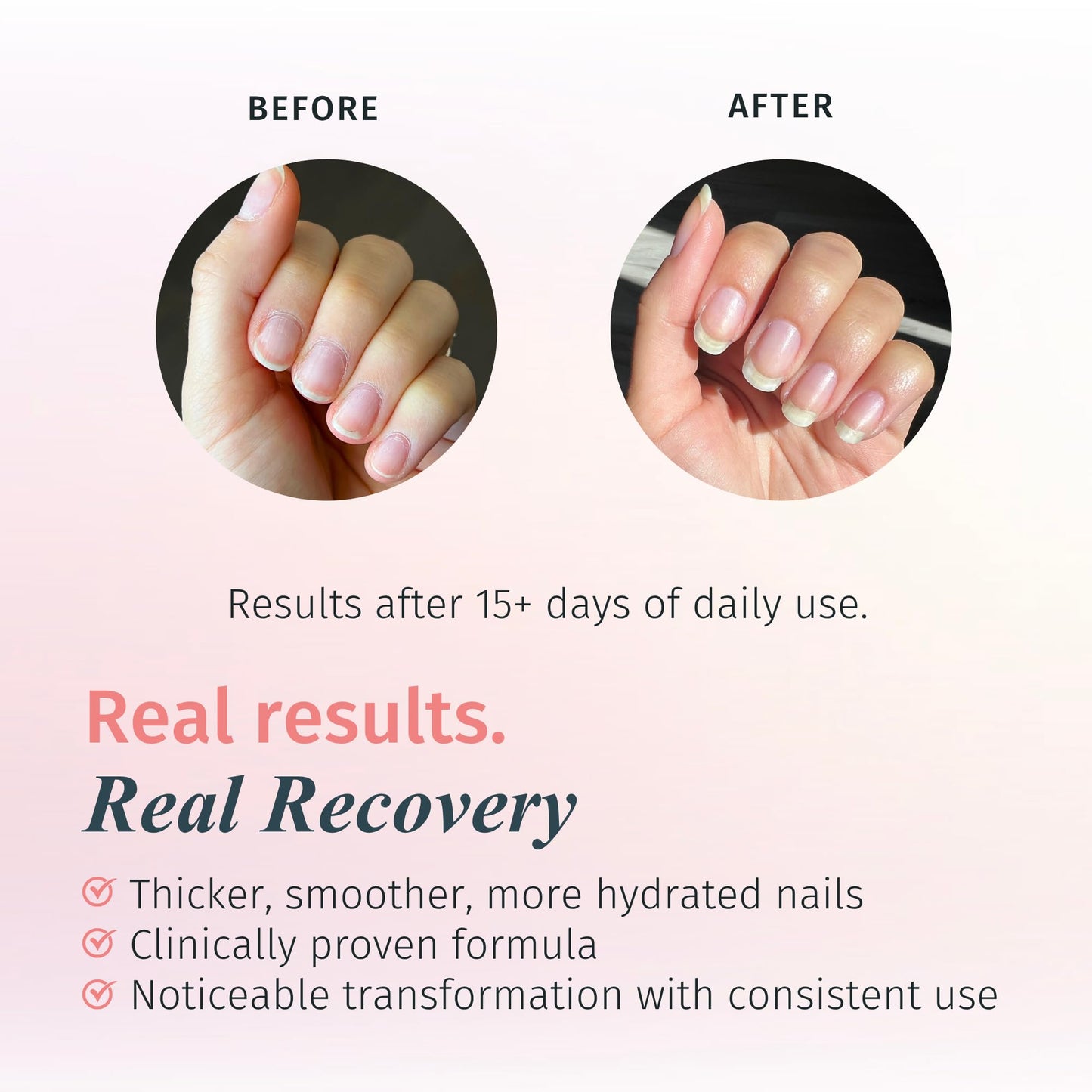 duri Rejuvacote 1 Nail Growth System - Maximum Strength | Nail Strengthener for Damaged Nails from Gel, Acrylic Manicure | Grow