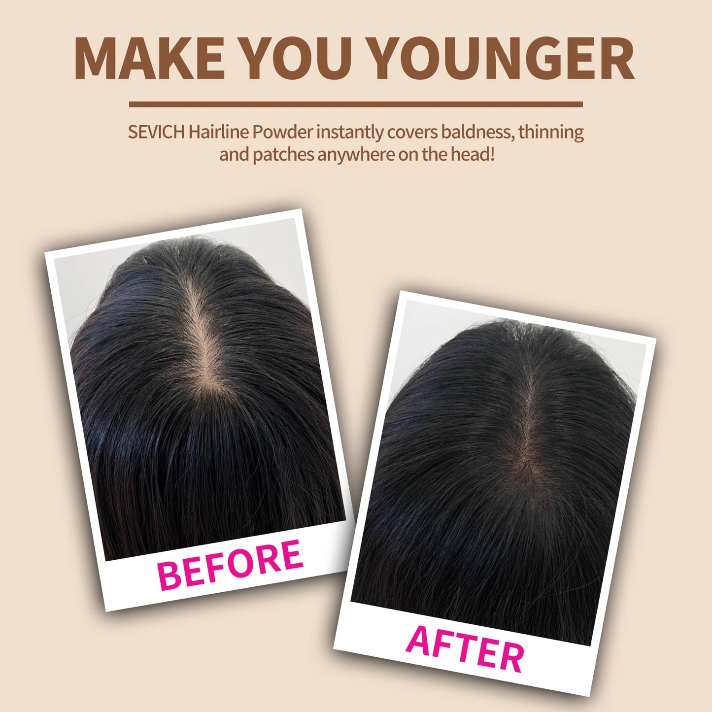 SEVICH Instantly Hairline Shadow Hairline Powder, Quick Cover Grey Hair Root Concealer, Eyebrows & Beard Line, Hair Root Touch U