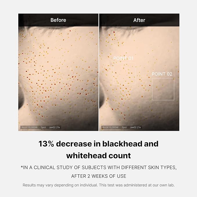 Medicube Zero Pore One-day Serum 1.01 fl.oz - Overnight Resurfacing Serum with Pore Tightening Complex - 15.2% AHA+BHA+PHA & 2% Niacinamide - 10.8% reduction in pore appearance after one day of use