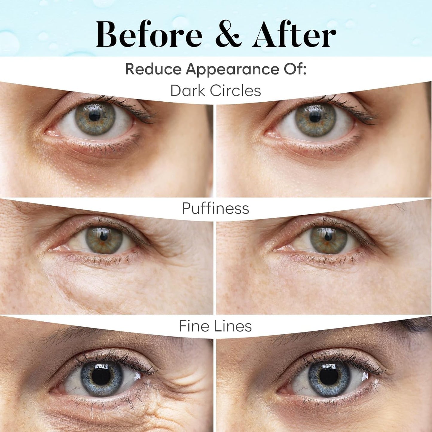 BLOOMORA Retinol & Collagen Under Eye Patches (30 Pairs), Under Eye Mask for Puffy Eyes, Appearance of Dark Circles, Smoothing &