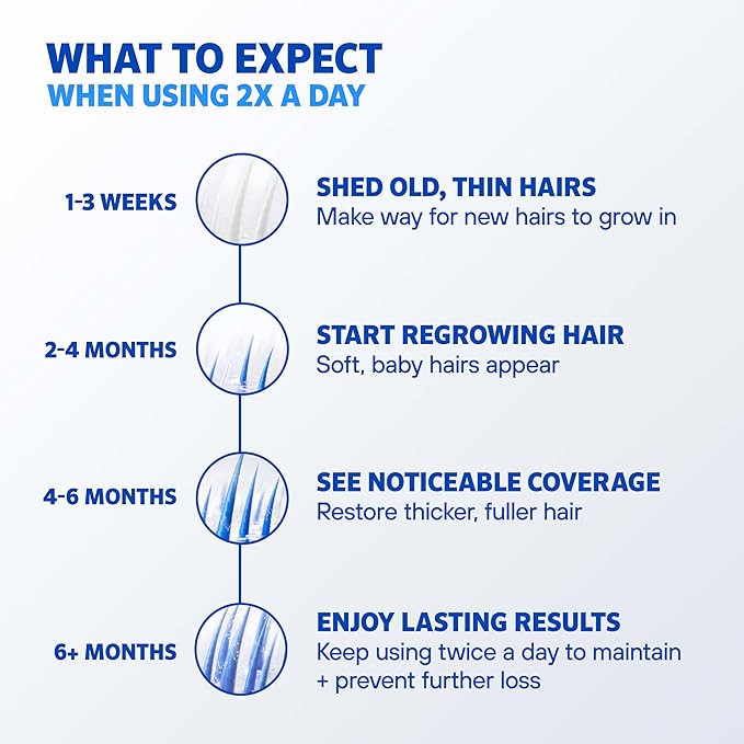 Men’s Rogaine 5% Minoxidil for Men Foam, Clinically Proven Regrowth for Thinning Hair, Topical Hair Loss Treatment, Unscented Topical Aerosol, Results in 8–16 Weeks, 3-Month Supply, 3 x 2.11 oz