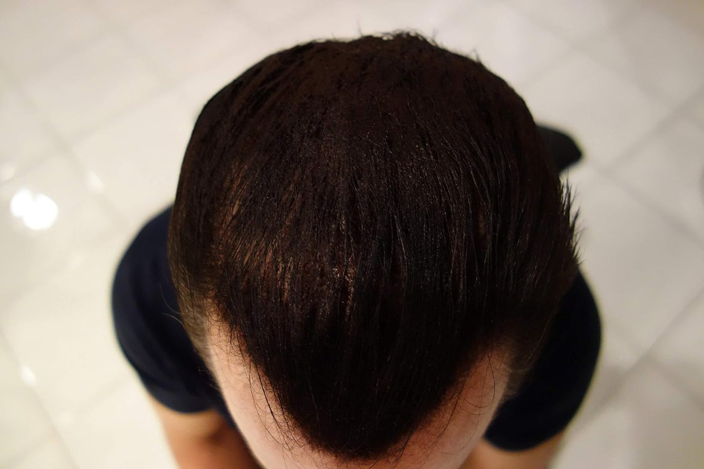 Hair Building Fibers 200 Grams 7 Oz. With Bottle By Finally Hair 50g*4 (Dark Salt & Pepper (very dark brown with a touch of white))