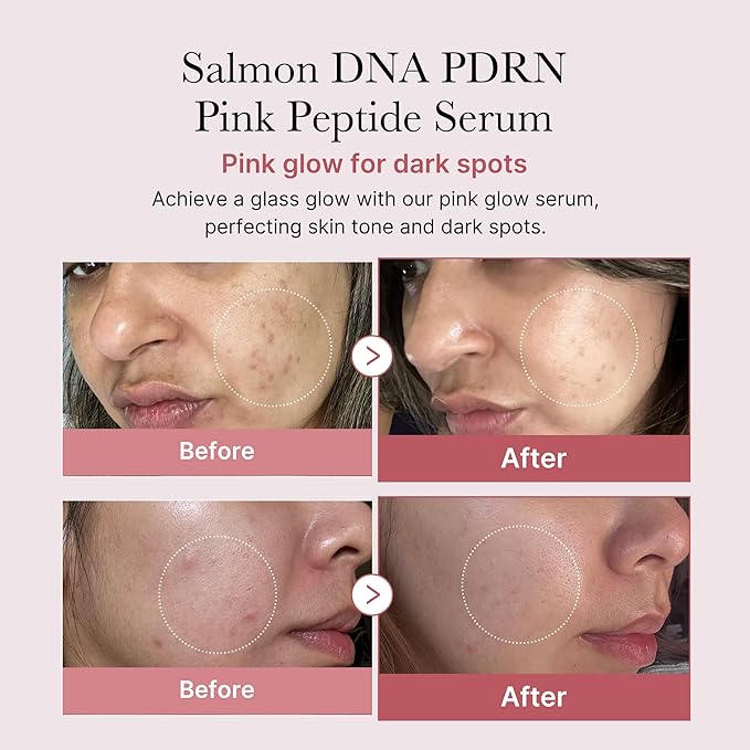 medicube PDRN Cleansing & Care Set: Salmon DNA PDRN Pink Peptide Serum and Pink Marshmallow Whip Cleanser