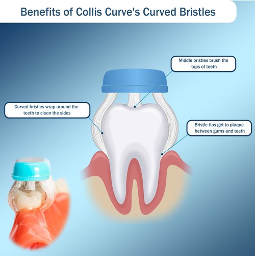 Collis Curve - Soft 3 Sided Toothbrush - Orthodontic Toothbrushes - Soft Bristle Toothbrush for Sensitive Gums, Bleeding Gums, Braces, Autistic, Adults and Children's Over 13 Years (Pack 12)