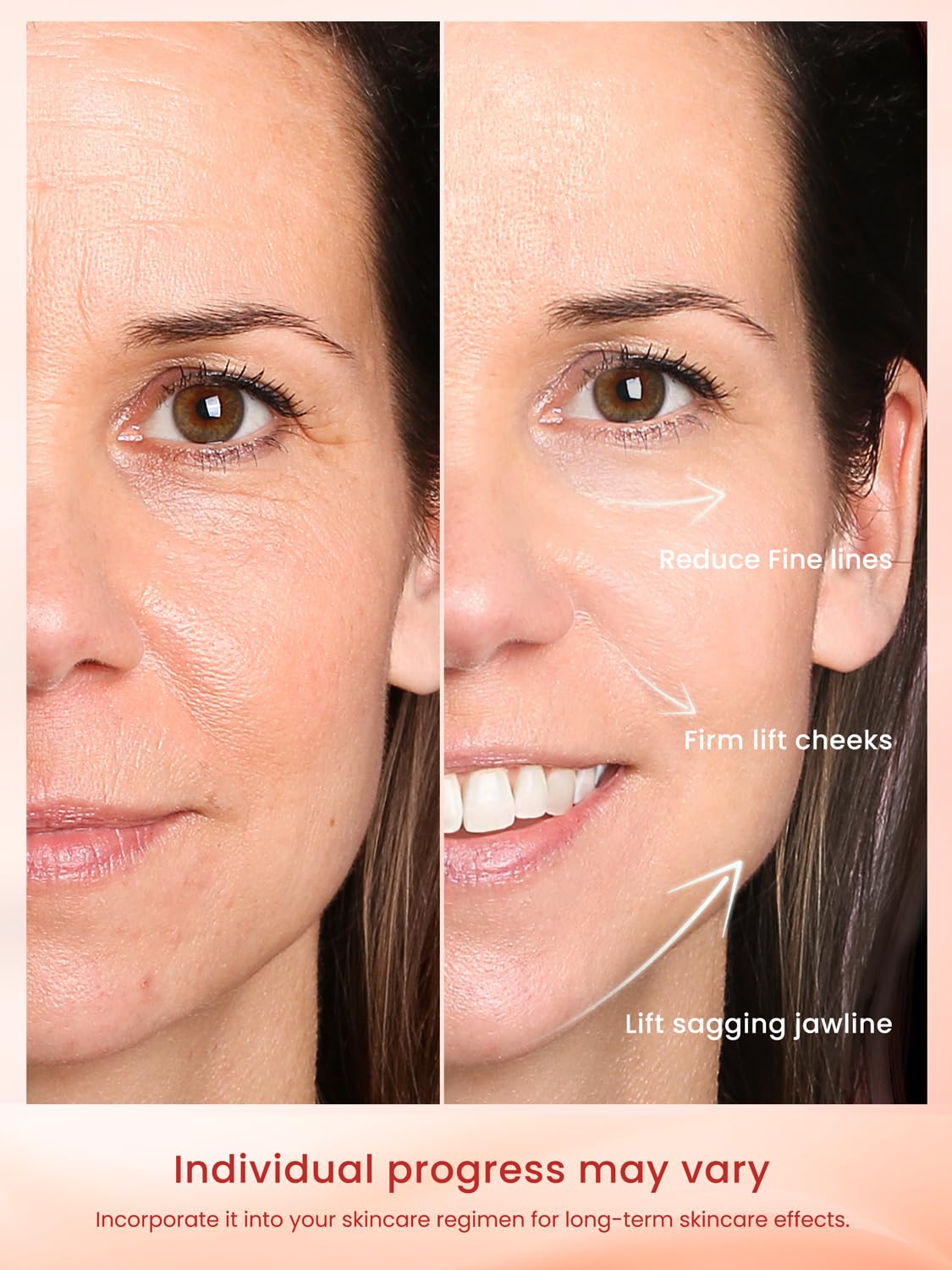 Radio Frequency Skin Tightening Device, Professional Wireless Home RF Face Machine for Anti-Aging, Wrinkle Reduction, Lifting, F