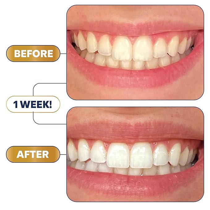 Lumineux Teeth Whitening Strips - 21 Treatments - Peroxide Free - Enamel Safe for Whiter Teeth - Whitening Without The Sensitivity - Dentist Formulated - Sensitivity