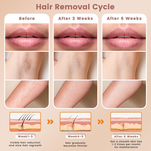 FELOOW IPL Hair Removal Device, Hair Removal for Women and Men at home for Armpits Legs Arms Bikini Line，model S3