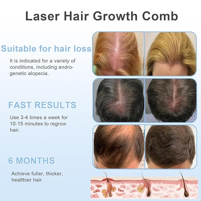 Laser Hair Growth Comb